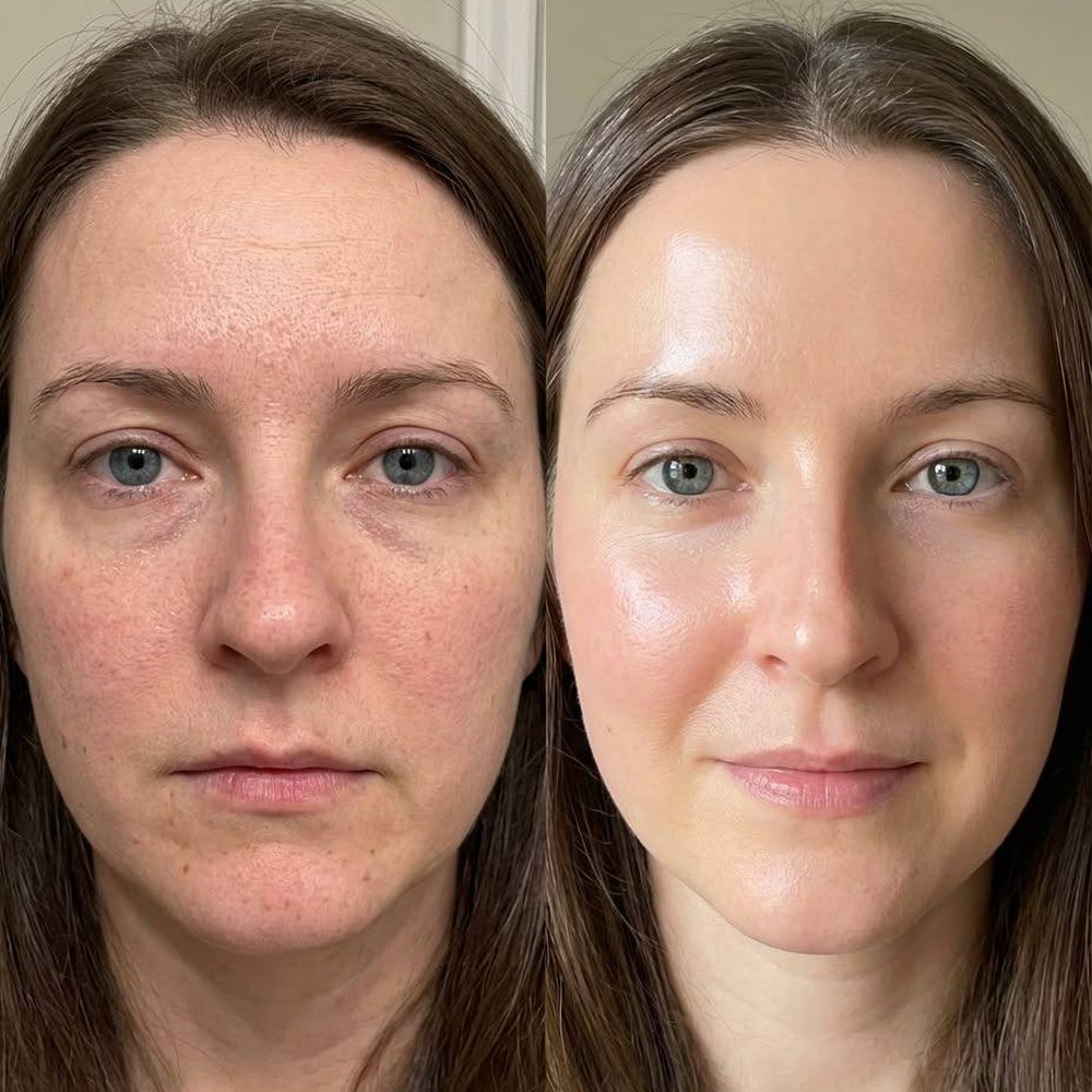 Client before and after result