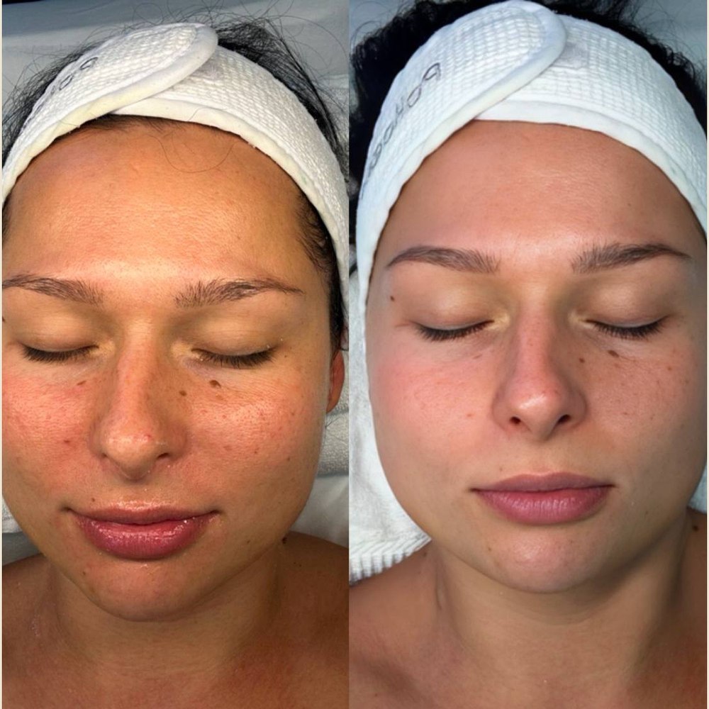 Client before and after result