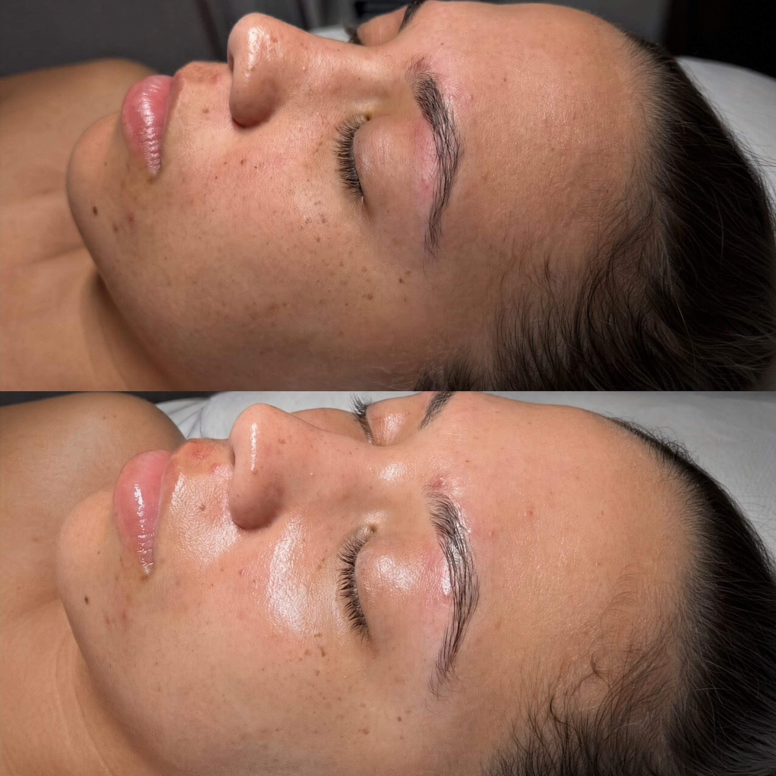 Client before and after result