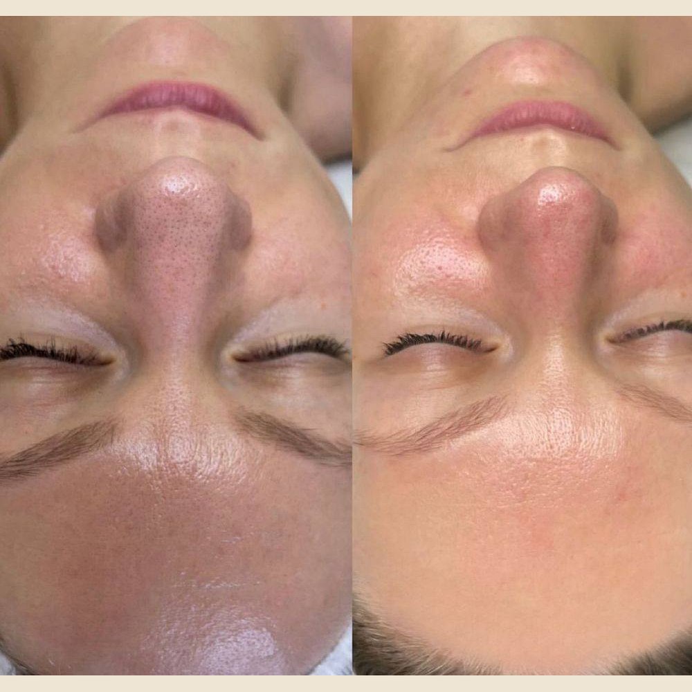 Client before and after result