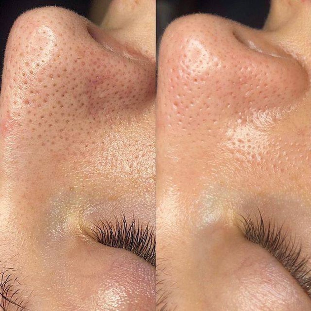 Client before and after result