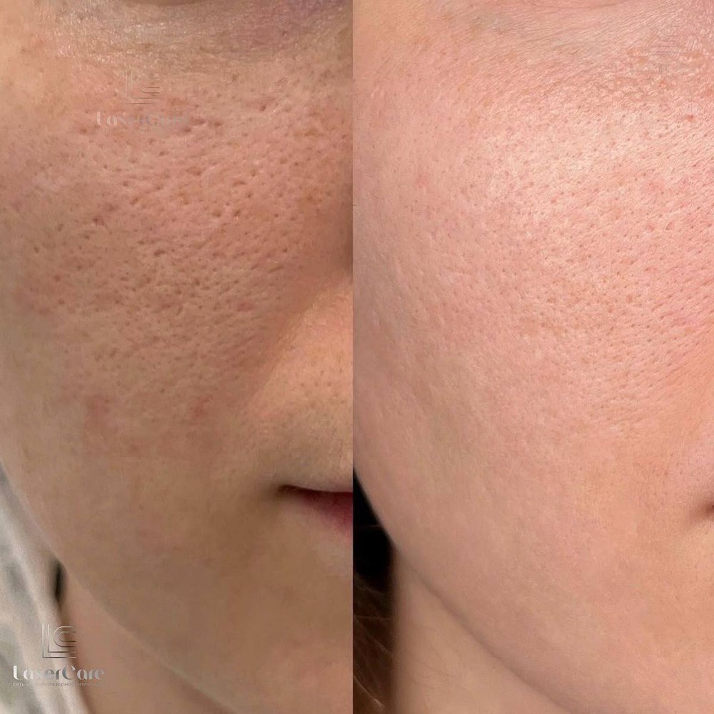 Client before and after result