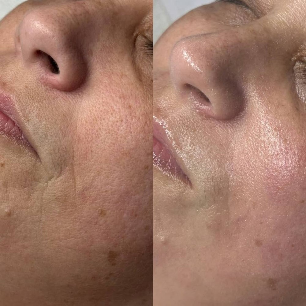 Client before and after result